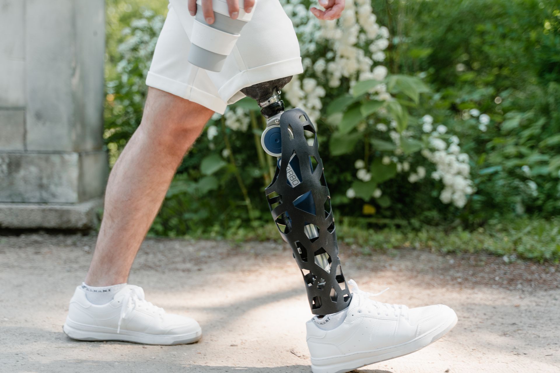 Person with prosthetic leg experiencing phantom limb pain after amputation