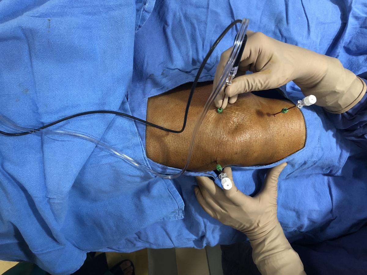 Doctor performing a knee injection procedure