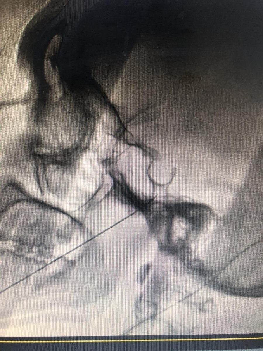 Doctor performing an image-guided facial nerve procedure